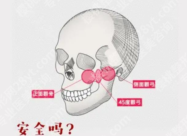 苏州颧骨整形医院排名清单一览！当地口碑医院2025榜单更新！