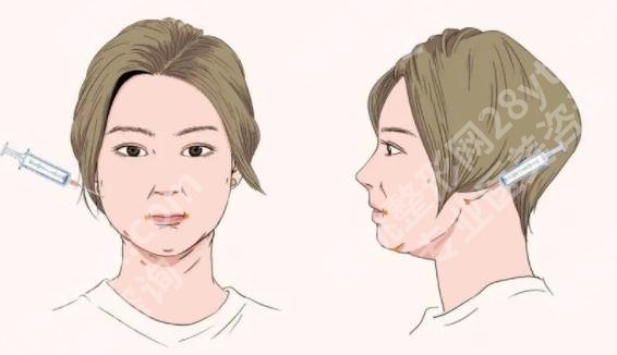 北京面部吸脂医生排行榜单曝光！各机构凭借着实力排名比较靠前