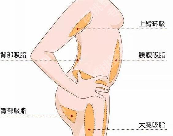 诸暨人民医院腹壁整形怎么样？含医院资料与适合人群看这里