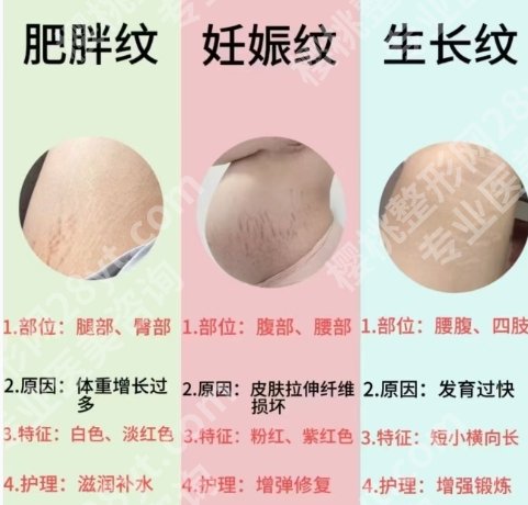 北京协和医院腹壁整形专家排名榜单更新！个个实力、技术超群！