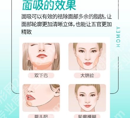 唐都医院抽脂价格贵不贵？2025收费标准一览！戳进来看