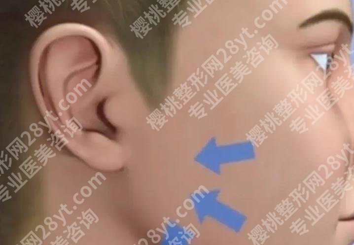 北京轮廓固定注射整形医院排名榜清单一览！