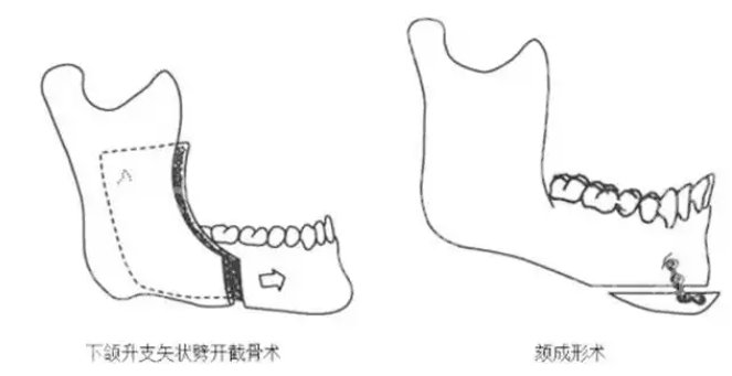 首口颏成型怎么预约？戳进来看真实的顾客评价吧！
