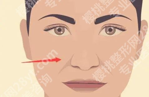 山东省立医院打玻尿酸价格贵不贵？真实案例|见证TA的蜕变