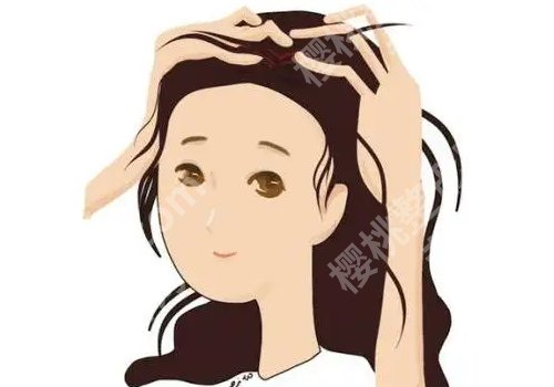 华中科技大学同济医院植发好吗？评价好！收费透明！实力推荐！