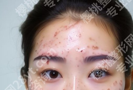 长春激光祛斑三甲医院名单分享了，附详细地址+代表医生
