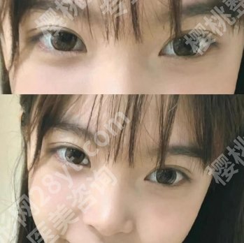 上海朱迪医生做眼睛怎么样？医生特色项目介绍