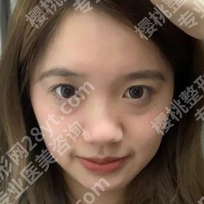 王保志医生做眼袋怎么样？技术点评、网友案例反馈！