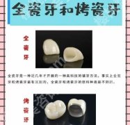 深圳同步齿科牙冠价格怎么样？看顾客的亲身点评内容