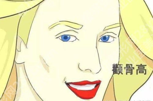 北京张笑天颧骨内推怎么样?医生介绍及案例更新!