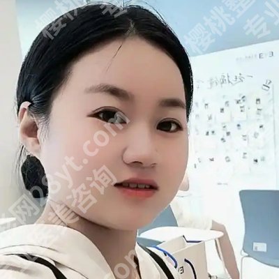 重庆西南医院植发找哪个医生？王量医生技术成稳、审美在线！