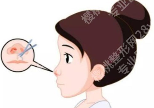 高海鹰医美怎么样？实力雄厚、技术靠谱！附案例