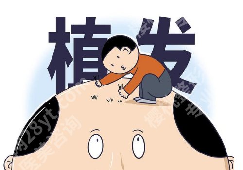北京301医院植发怎么样？实力口碑并存！内附挂号攻略！