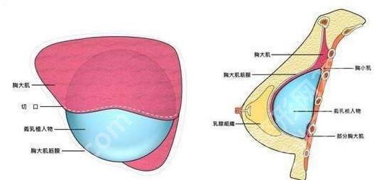 郑州集美隆胸怎么样？胸部整形小tips分享！附费用