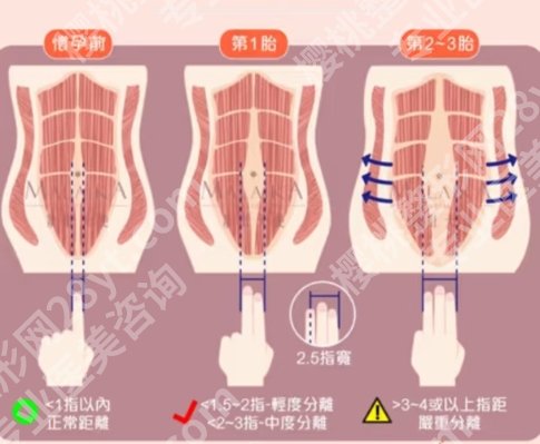 北华大学附属医院腹壁整形专家名单汇总！一键查收这份人气榜单