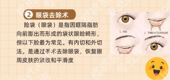 许春鹏医生做内切眶隔释放眼袋怎么样？明星项目介绍！