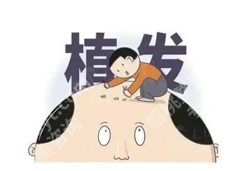 杨娟敏医生植发怎么样？技术靠谱吗？案例一览！