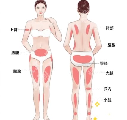 上海长征医院抽脂怎么样？经典案例展示|见证美丽蜕变！