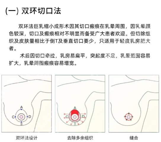 珠江医院缩胸手术费用！附术后注意事项！就诊必看！
