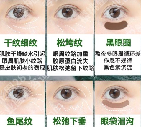 浙一医院祛眼袋多少钱？2025收费标准更新！就诊必看