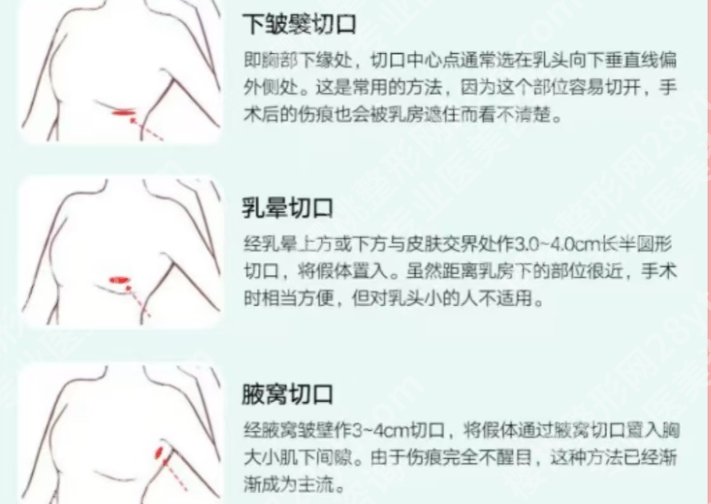 南华附二医院丰胸多少钱？医院优势介绍及价格参考！