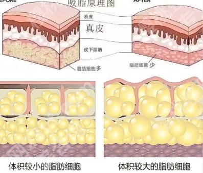 郑州天后陈三群手术案例展示!擅长项目介绍!就诊必看