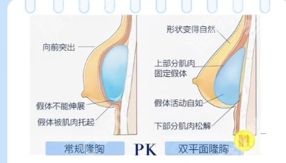 黄渭清医生隆胸痛不痛?网友亲身面诊过程分享!附反馈