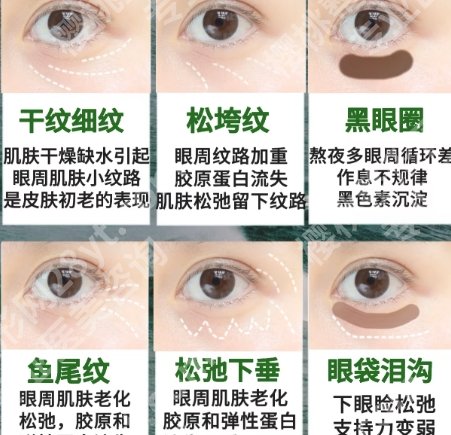 杭州艺星做超声炮怎么样？价格贵不贵？2025收费标准更新！