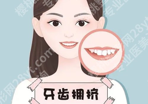 宁波第一医院牙齿矫正哪个医生好？乔阳、赵超越、李偲等曝光！