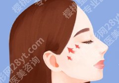 上海华山医院颧骨内推多少钱？价格详情、医生实力公开！