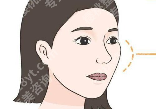上海华山医院颧骨内推多少钱？价格详情、医生实力公开！