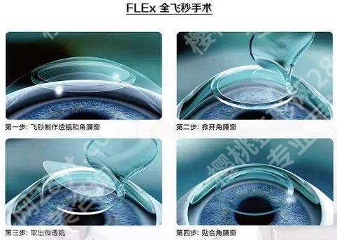 北京大学深圳医院近视手术哪个医生好？内附李海武、李金瑛、陈仪乐详情