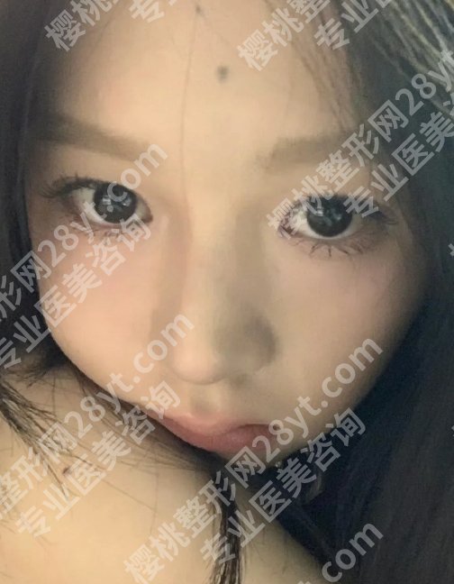 黄渭清眼袋价格是多少？低至100元起，附医生信息盘点！