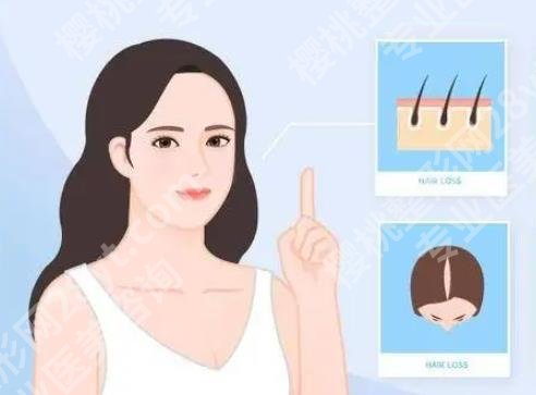 延吉植发多少钱？如何选择医院？植发术后tips分享！