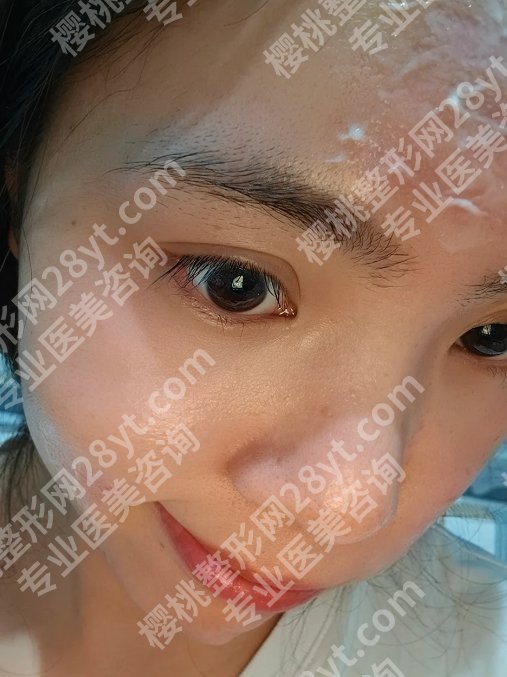 北京协和医院点阵激光美容是直接做还是预约？医生信息曝光！附25年价格表