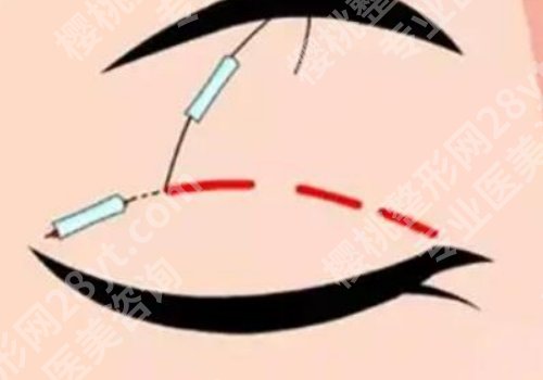 北京世纪坛医院美容科怎么样？医院基本信息、科普项目推荐！