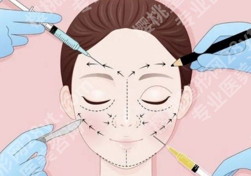 成都李烈个人资料简介来袭！分享医生详情及操作案例！