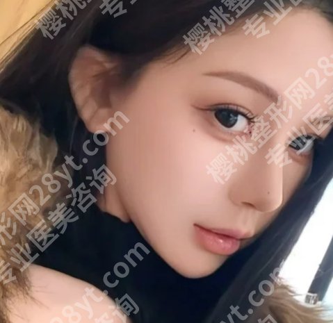 魏皎医生鼻子案例分享!医生资料、案例详情来袭!