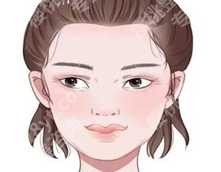 苏薇洁医生值得信赖吗？坐诊医院和双眼皮案例分享