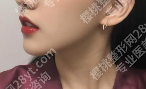 上海长征医院磨骨手术价格多少？真人做磨骨手术流程记录！