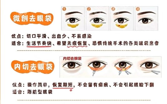姜平医生做眼袋案例!附真实口碑点评来袭!收藏再看!