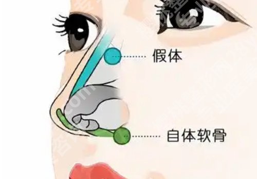 广州郭栋做鼻子怎么样？医生介绍、技术特色更新！
