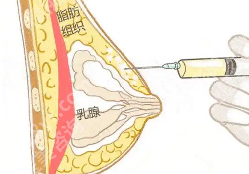 易成刚擅长项目更新！附医生基本信息在线了解！