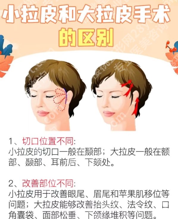 协和拉皮手术做的好吗?拉皮手术案例曝光!
