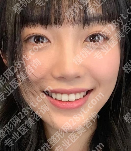 杨浦区中心医院双眼皮价格是多少？低至4000元起，附医生简介！