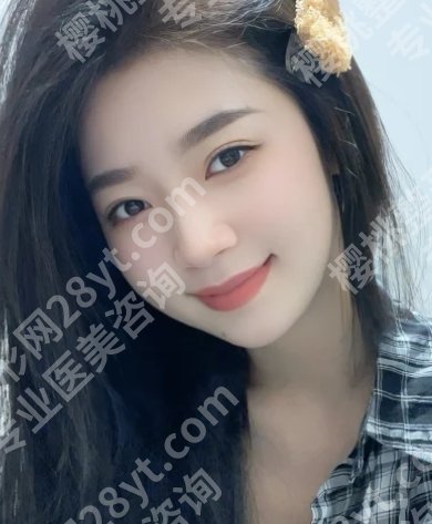 季滢医生筋膜提升怎么样?技术实力在线!优势公布!