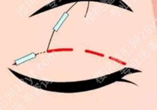 金骥医生技术优势来袭！医生信息曝光！25年价格明细一览！