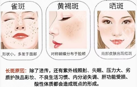 上海第九医院祛斑多少钱？医院价格表动态及技术优势！
