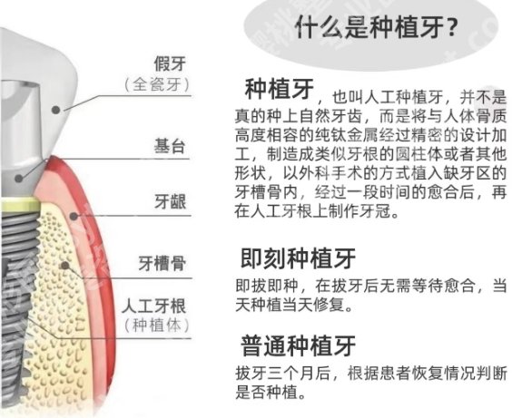 南昌种植牙医院排名！医院实力出众凭实力上榜！