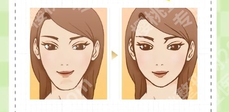 杭州磨骨哪个医生好？医生实力在线特色项目参考!